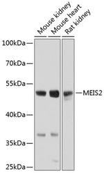 MEIS2 Polyclonal Antibody