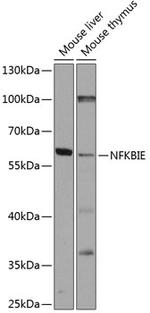 IkB epsilon Polyclonal Antibody