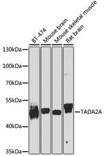 TADA2L Polyclonal Antibody