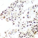 HIRA Antibody in Immunohistochemistry (Paraffin) (IHC (P))