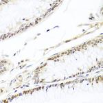 HIRA Polyclonal Antibody