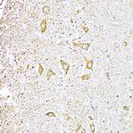 UVRAG Polyclonal Antibody