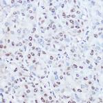 TAF15 Polyclonal Antibody