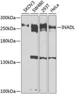 PATJ Polyclonal Antibody
