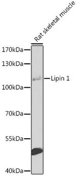 LPIN1 Polyclonal Antibody
