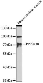 PPP2R3B Antibody in Western Blot (WB)