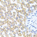 RIPK4 Antibody in Immunohistochemistry (Paraffin) (IHC (P))
