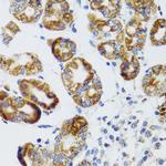 RIPK4 Antibody in Immunohistochemistry (Paraffin) (IHC (P))