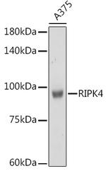 RIPK4 Antibody in Western Blot (WB)