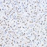 SMEK1 Antibody in Immunohistochemistry (Paraffin) (IHC (P))