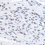 SMEK1 Polyclonal Antibody
