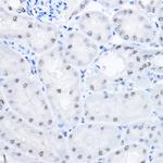 SMEK1 Antibody in Immunohistochemistry (Paraffin) (IHC (P))