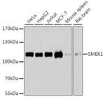 SMEK1 Antibody in Western Blot (WB)
