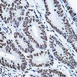 MKL1 Antibody in Immunohistochemistry (Paraffin) (IHC (P))