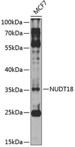 NUDT18 Polyclonal Antibody