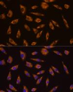 GLP1R Polyclonal Antibody