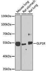 GLP1R Antibody in Western Blot (WB)