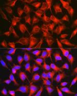 CD171 Antibody in Immunocytochemistry (ICC/IF)