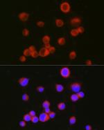 CD171 Antibody in Immunocytochemistry (ICC/IF)
