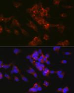 CD171 Antibody in Immunocytochemistry (ICC/IF)