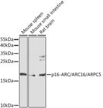 ARPC5 Polyclonal Antibody