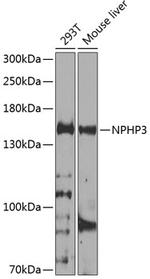 NPHP3 Polyclonal Antibody