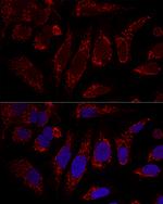 CHCHD3 Antibody in Immunocytochemistry (ICC/IF)