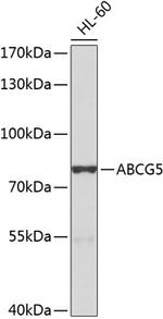 ABCG5 Polyclonal Antibody