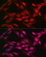 Importin beta-1 Polyclonal Antibody