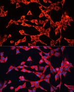 GDI2 Polyclonal Antibody