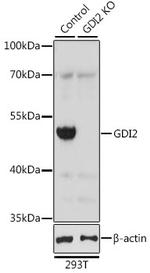 GDI2 Antibody in Western Blot (WB)