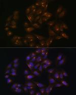 SNX1 Polyclonal Antibody