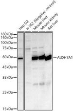ALDH7A1 Antibody in Western Blot (WB)