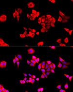 eIF3j Antibody in Immunocytochemistry (ICC/IF)