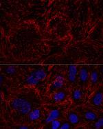 Septin-9 Polyclonal Antibody
