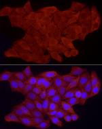 FHL3 Polyclonal Antibody