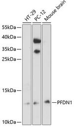 PFDN1 Polyclonal Antibody