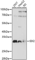 SIX2 Polyclonal Antibody