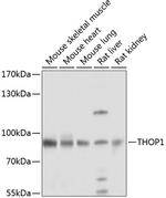 Thimet Oligopeptidase Polyclonal Antibody