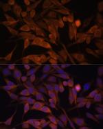 Calcyclin Antibody in Immunocytochemistry (ICC/IF)