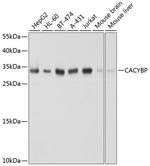 Calcyclin Antibody in Western Blot (WB)