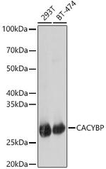 Calcyclin Antibody in Western Blot (WB)