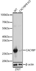 Calcyclin Antibody in Western Blot (WB)