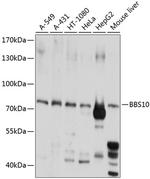 BBS10 Polyclonal Antibody
