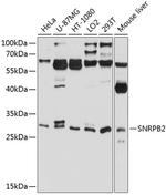 SNRPB2 Polyclonal Antibody