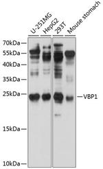 VBP1 Polyclonal Antibody