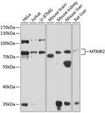 MTMR2 Polyclonal Antibody