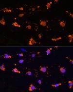 SIRP alpha Antibody in Immunocytochemistry (ICC/IF)