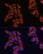 SIRP alpha Polyclonal Antibody
