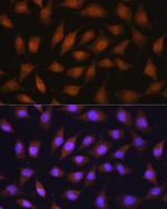 RPSA Antibody in Immunocytochemistry (ICC/IF)